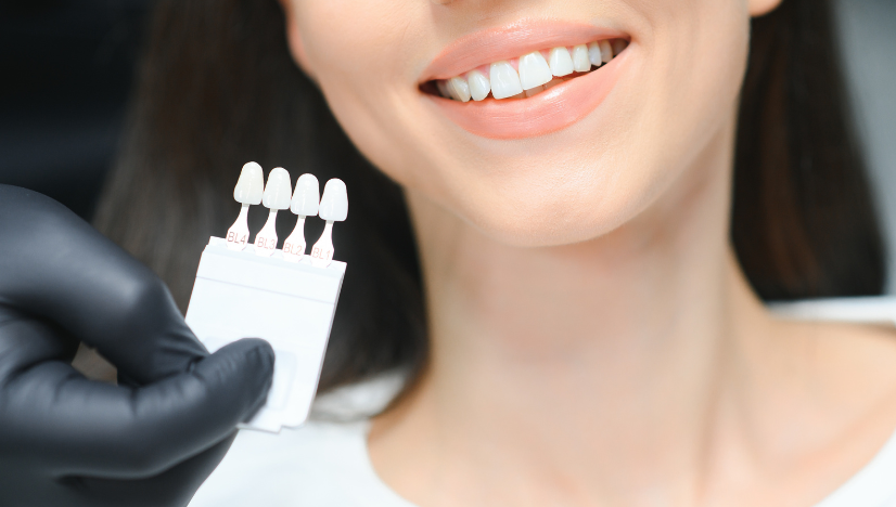 teeth Whitening Treatment