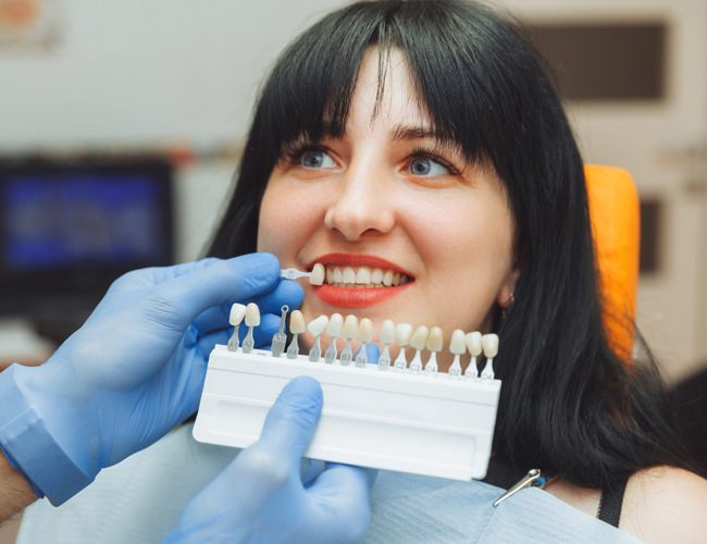 Porcelain Veneers - cascade dental care