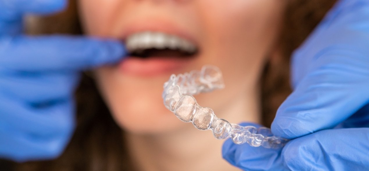 how long does invisalign take to fix gap teeth