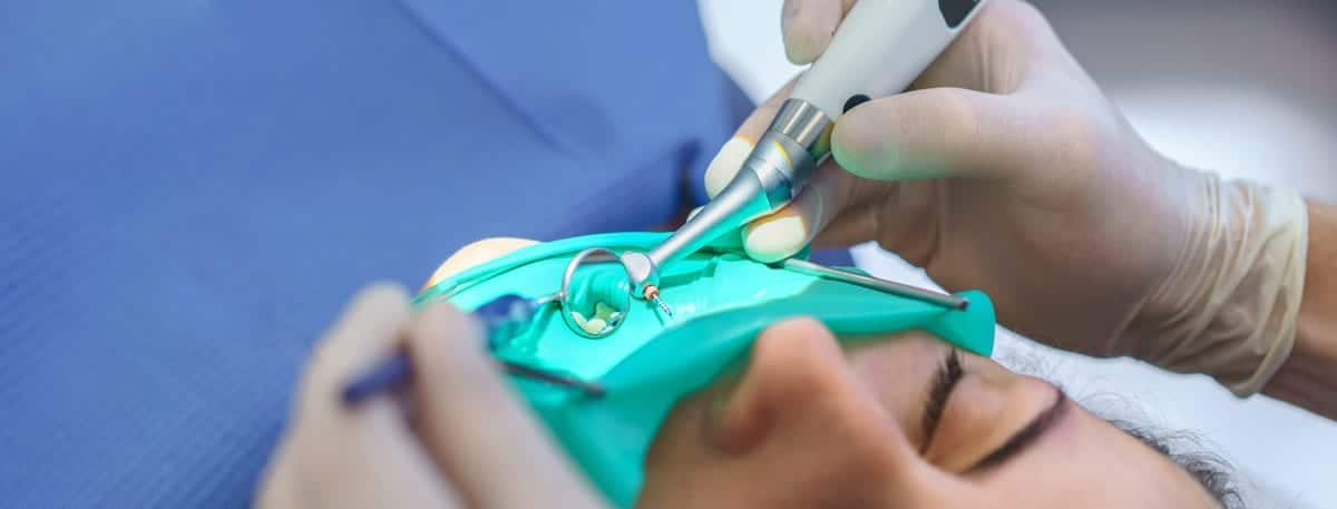 Root Canal Treatment in Spokane