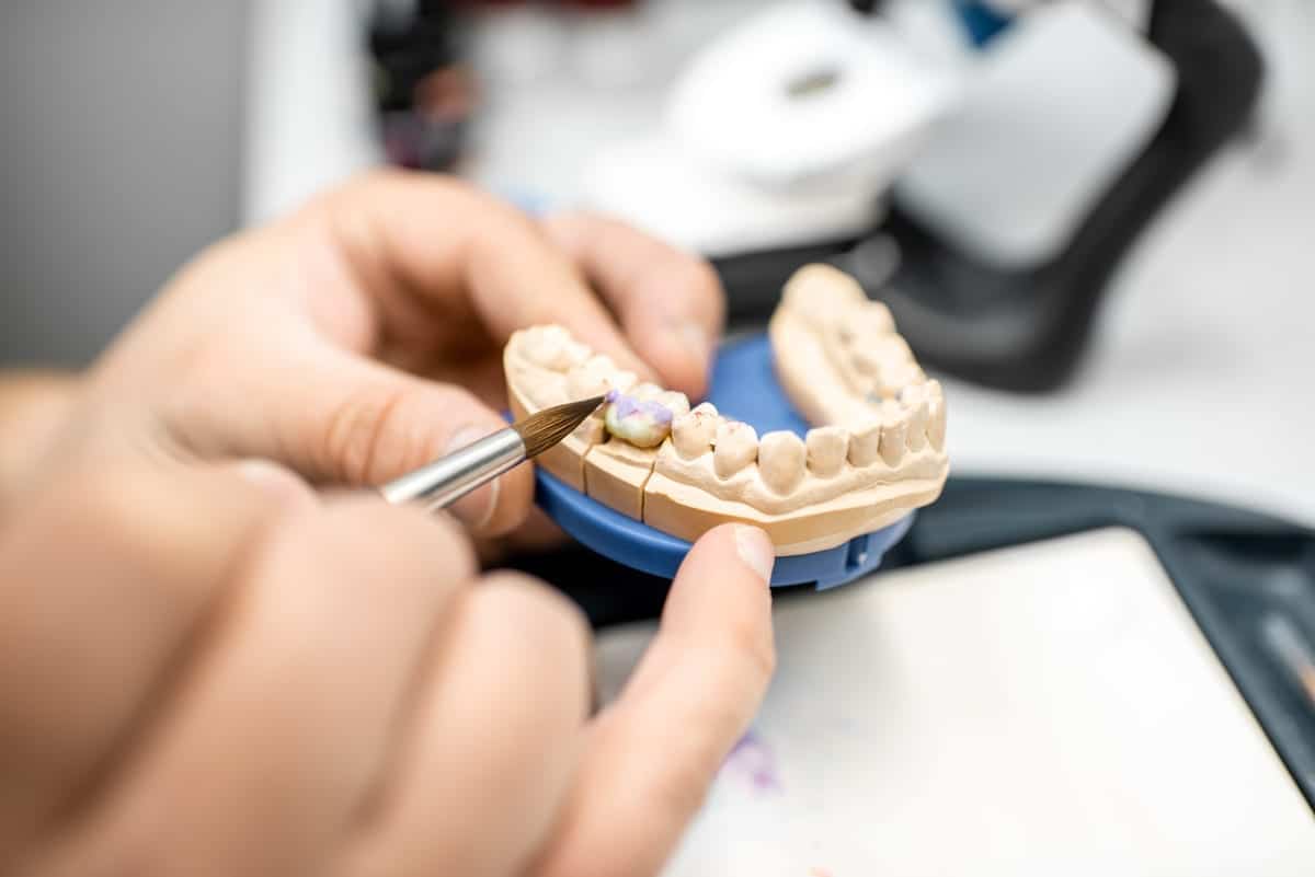Dental Crowns in Veradale